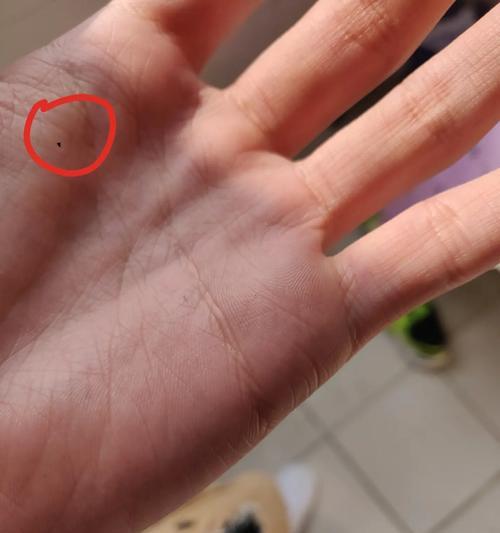 手机前置摄像头出现坏点的原因是什么？  第3张